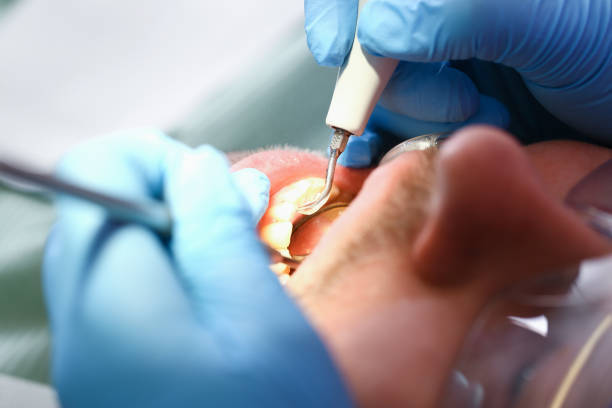 Emergency Gum Pain Relief in ID